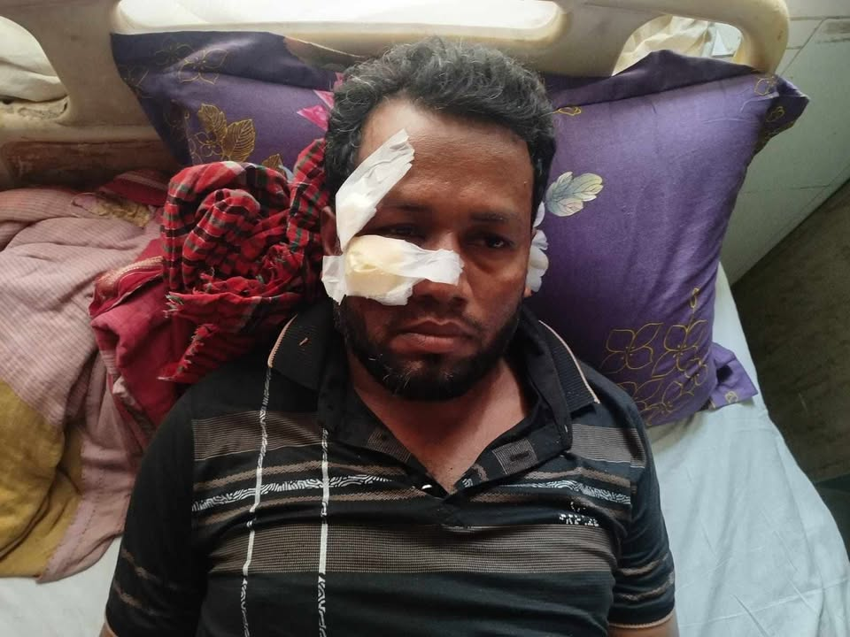 গোপালগঞ্জে জমি নিয়ে দুই ভাইয়ের সংঘর্ষে আহত এক, হাসপাতালে ভর্তি 4 IMG