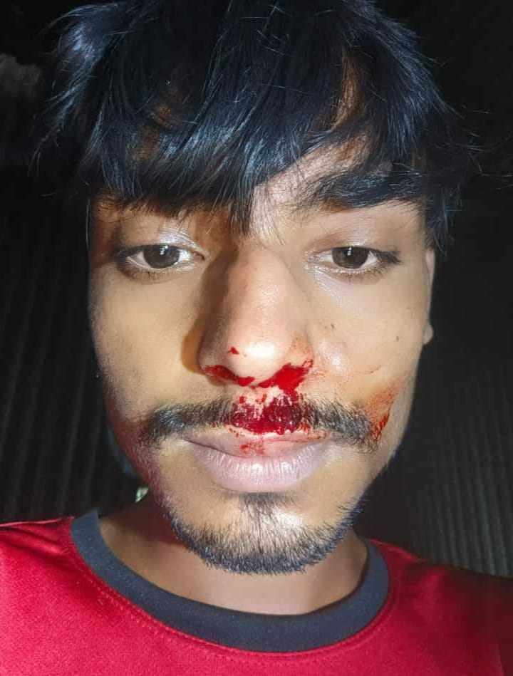 কুড়িগ্রামে রাজারহাটে ইউপি সদস্যের ঘুষিতে এক যুবক আহত। 4 img