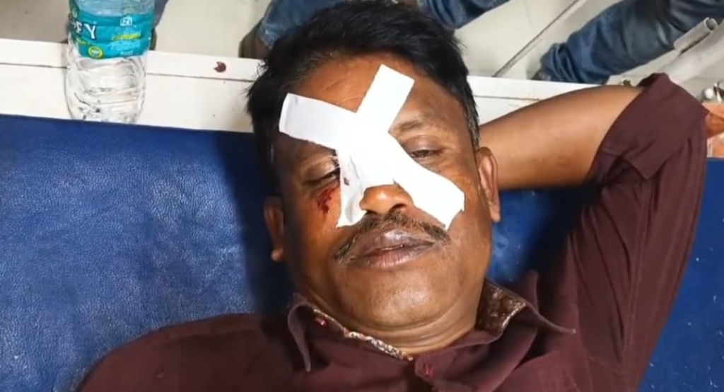 মুর্শিদাবাদের রঘুনাথগঞ্জে এক সাংবাদিকের উপর নিশংস হামলার অভিযোগ। 4 img